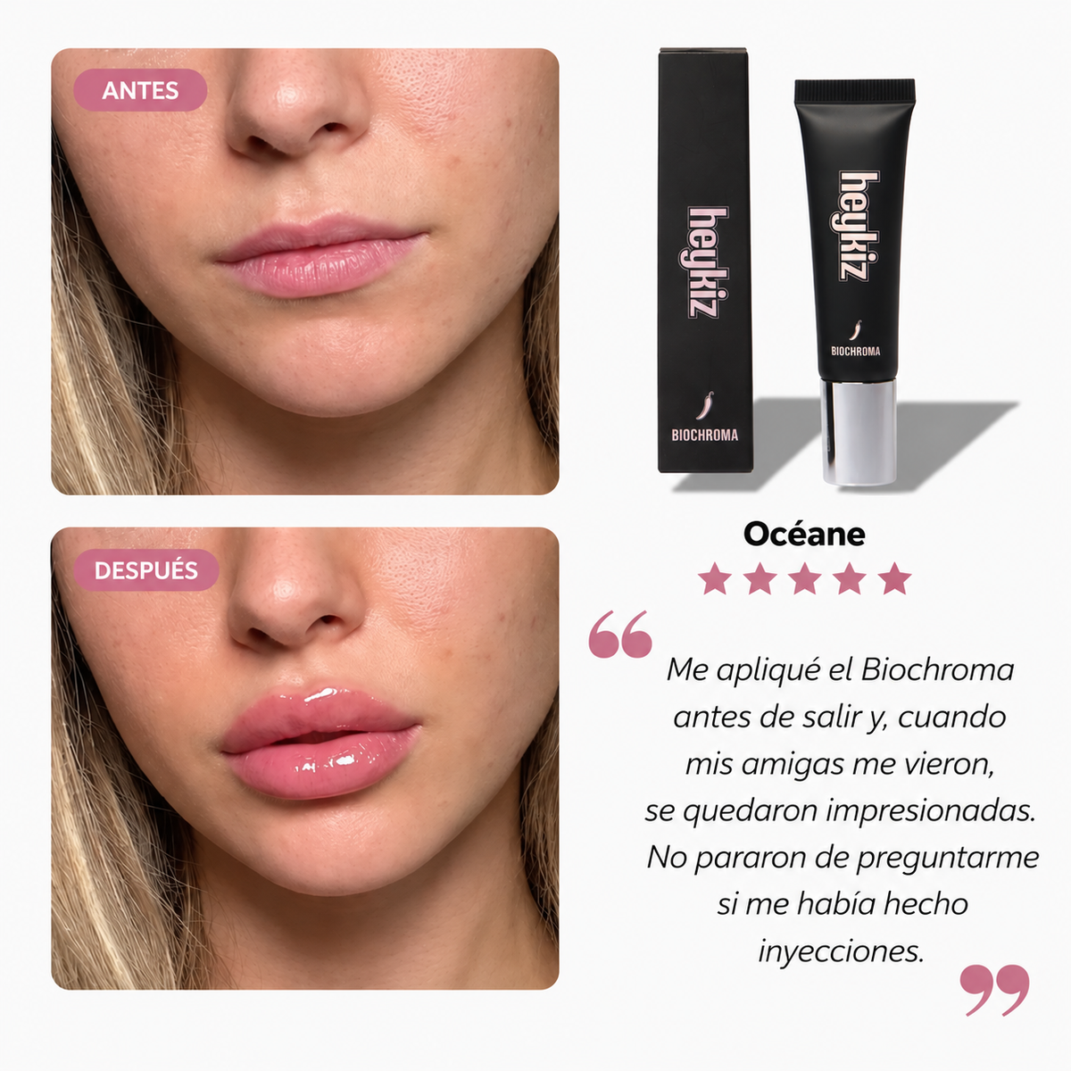 VOLUMINIZADOR DE LABIOS