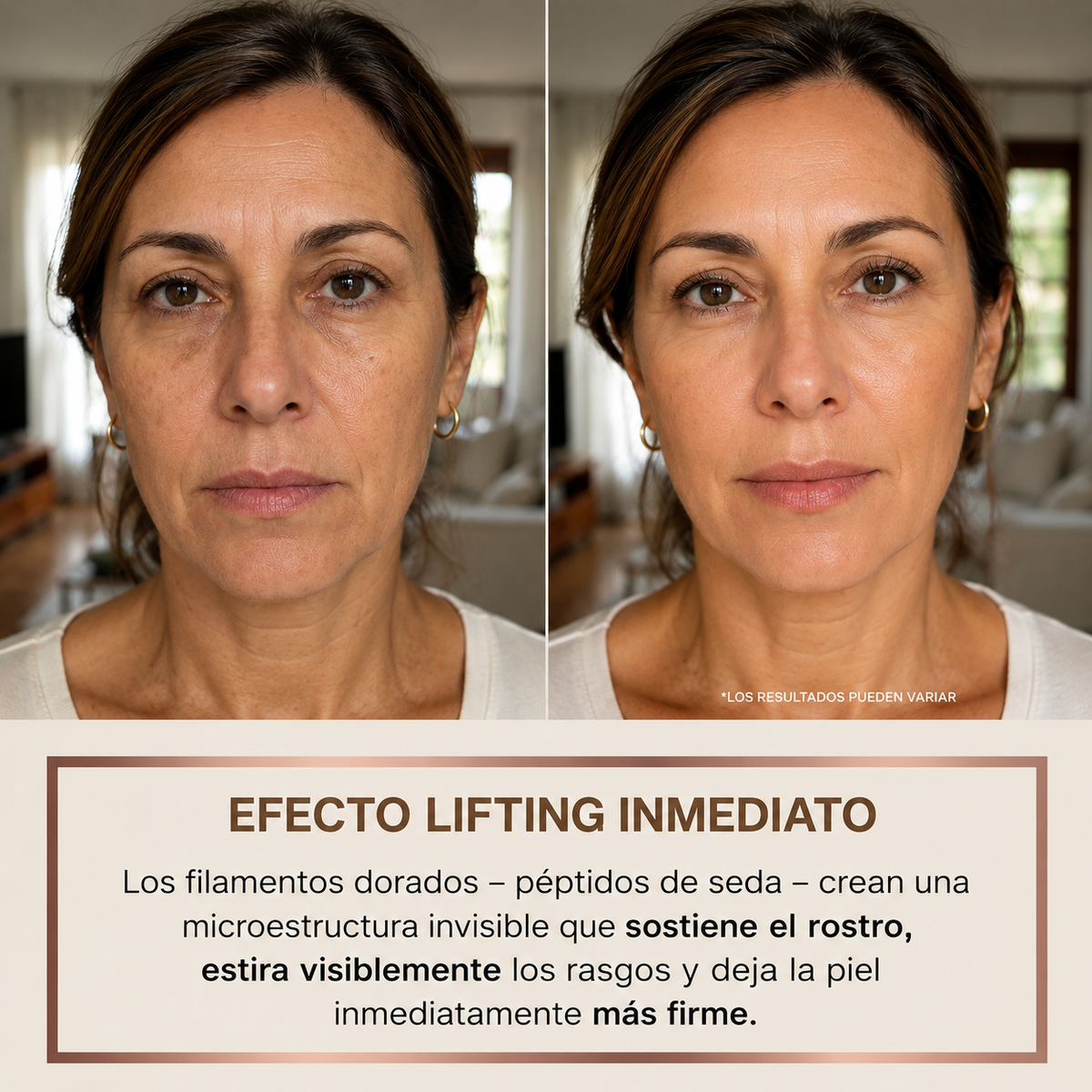Biochroma – Sérum coreano con efecto lifting (visible desde la primera aplicación)