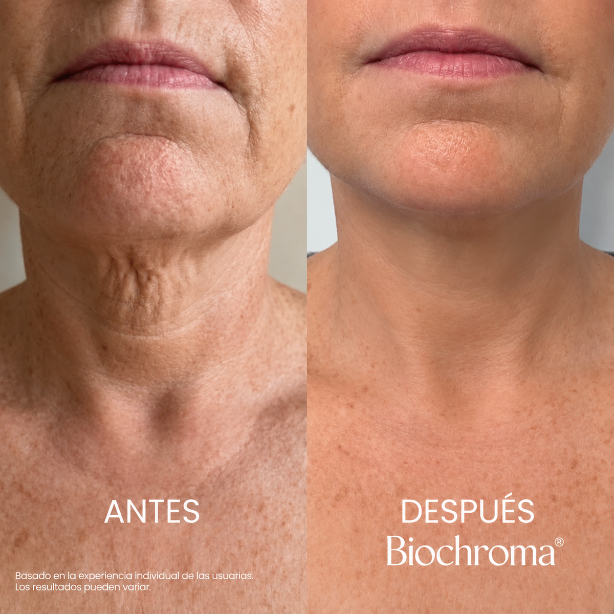 Crema Reafirmante y Tensora para el Cuello Biochroma®