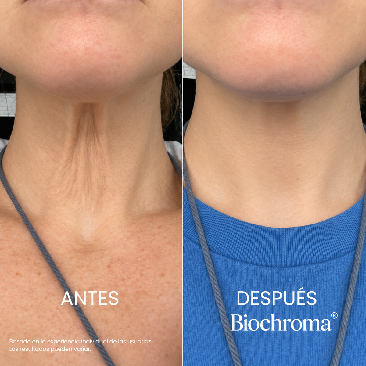 Crema Reafirmante y Tensora para el Cuello Biochroma®
