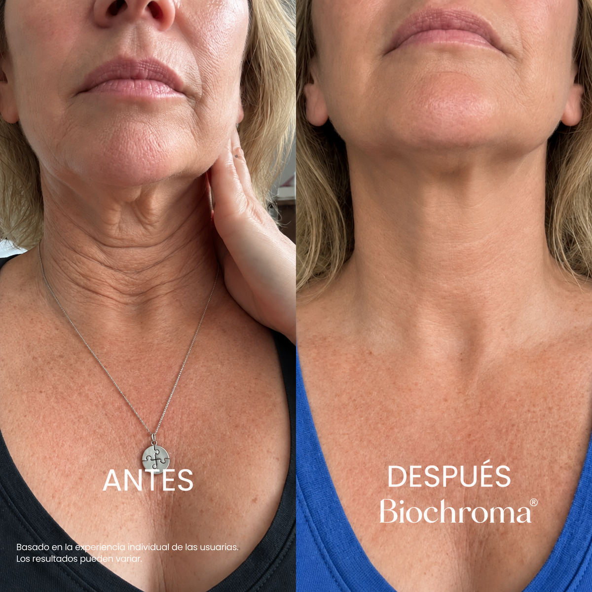 Crema Reafirmante y Tensora para el Cuello Biochroma®