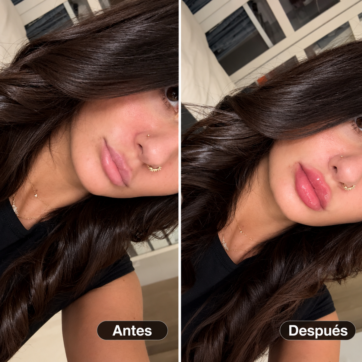 VOLUMINIZADOR DE LABIOS