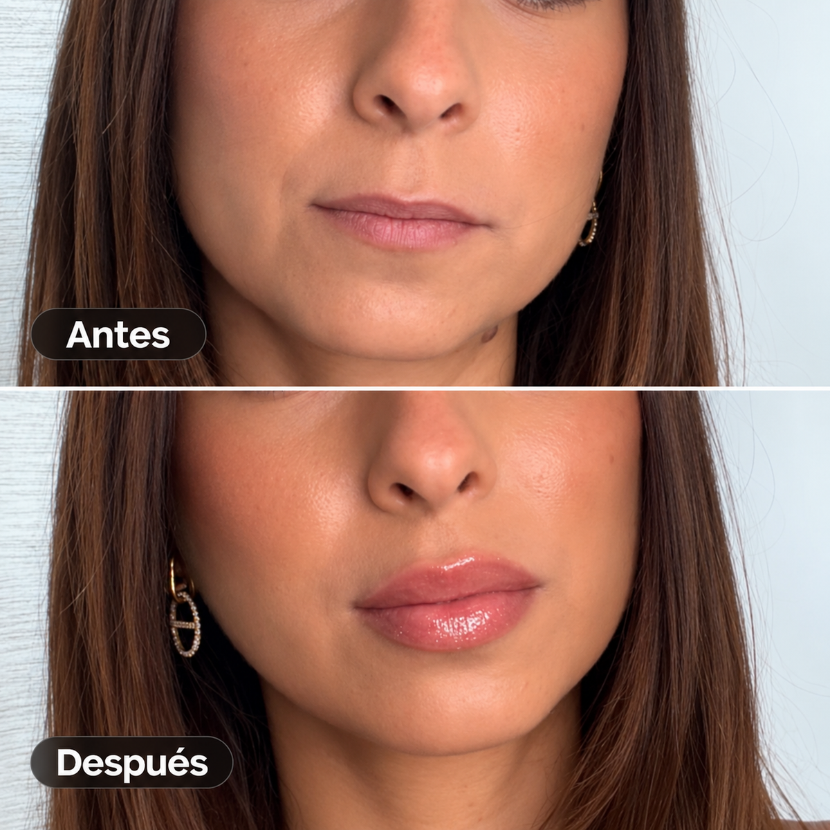 VOLUMINIZADOR DE LABIOS
